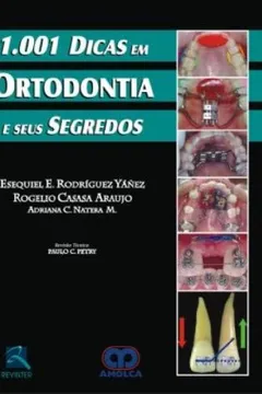 Livro 1.001 Dicas Em Ortodontia E Seus Segredos - Resumo, Resenha, PDF, etc.