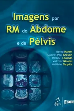 Livro Imagens Por Ressonancia Magnetica Do Abdome E Pelvis - Resumo, Resenha, PDF, etc.