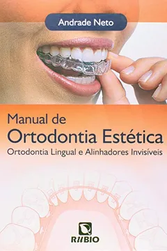 Livro Manual de Ortodontia Estética. Ortodontia Lingual e Alinhadores Invisíveis - Resumo, Resenha, PDF, etc.