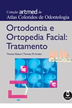 Livro Ortodontia e Ortopedia Facial. Tratamento - Resumo, Resenha, PDF, etc.