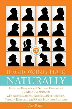 Livro Regrowing Hair Naturally: Effective Remedies and Natural Treatments for Men and Women with Alopecia Areata, Alopecia Androgenetica, Telogen Effl [With - Resumo, Resenha, PDF, etc.