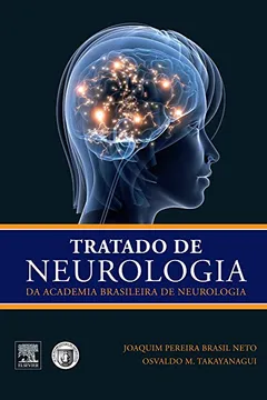 Livro Tratado de Neurologia da Academia Brasileira de Neurologia - Resumo, Resenha, PDF, etc.