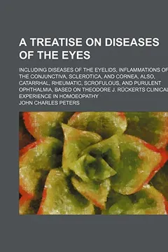 Livro A Treatise on Diseases of the Eyes; Including Diseases of the Eyelids, Inflammations of the Conjunctiva, Sclerotica, and Cornea, Also, Catarrhal, ... Ruckerts Clinical Experience in Homoeopathy - Resumo, Resenha, PDF, etc.
