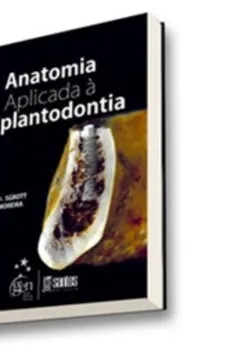 Livro Anatomia Aplicada A Implantodontia - Resumo, Resenha, PDF, etc.