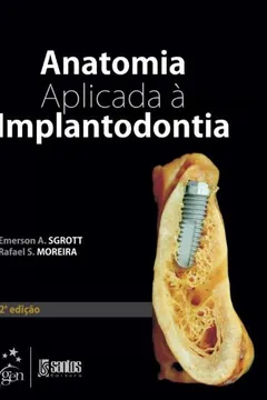 Livro Anatomia Aplicada A Implantodontia - Resumo, Resenha, PDF, etc.