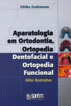 Livro Aparatologia Em Ortodontia, Ortopedia Dentofacial E Ortopedia Funciona - Resumo, Resenha, PDF, etc.