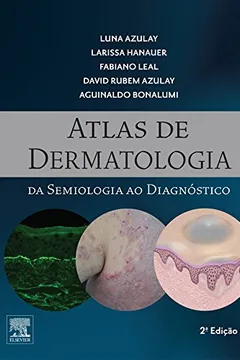 Livro Atlas de Dermatologia da Semiologia ao Diagnóstico - Resumo, Resenha, PDF, etc.