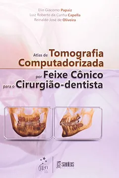 Livro Atlas De Tomografia Computadorizada Por Feixe Conico Para O Cirurgiao-Dentista - Resumo, Resenha, PDF, etc.