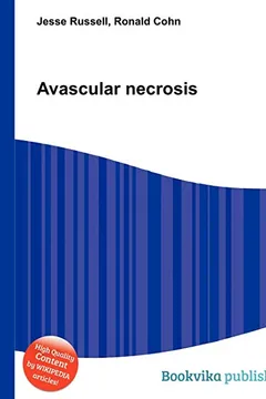 Livro Avascular Necrosis - Resumo, Resenha, PDF, etc.