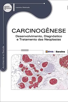 Livro Carcinogênese. Desenvolvimento, Diagnóstico e Tratamento das Neoplasias - Resumo, Resenha, PDF, etc.