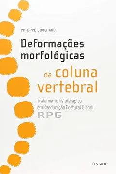 Livro Deformações Morfológicas da Coluna Vertebral - Resumo, Resenha, PDF, etc.