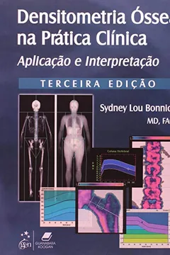 Livro Densitometria Ossea Na Prática Clinica. Aplicação E Interpretação - Resumo, Resenha, PDF, etc.