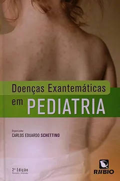 Livro Doenças Exantemáticas em Pediatria - Resumo, Resenha, PDF, etc.