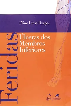 Livro Feridas - Ulceras De Membros Inferiores - Resumo, Resenha, PDF, etc.