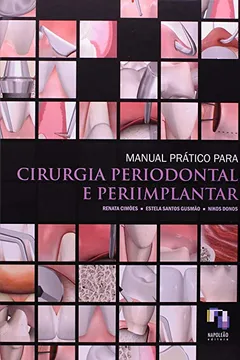 Livro Manual Prático De Cirurgia Periodontal - Resumo, Resenha, PDF, etc.