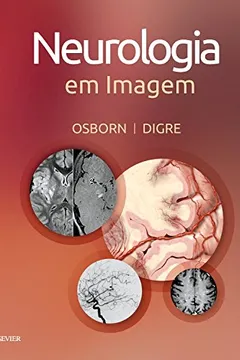 Livro Neurologia em Imagem - Resumo, Resenha, PDF, etc.