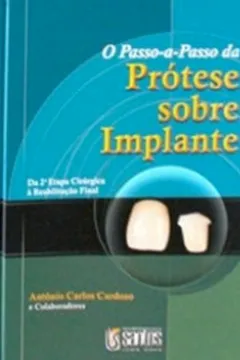 Livro O Passo-A-Passo da Prótese Sobre Implante - Resumo, Resenha, PDF, etc.