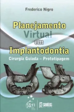 Livro Planejamento Virtual Em Implantodontia - Cirurgia Guiada-Prototipagem - Resumo, Resenha, PDF, etc.