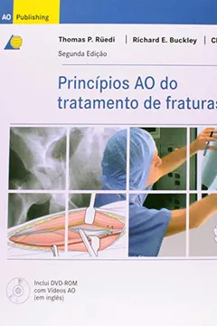 Livro Princípios AO do Tratamento de Fraturas - Resumo, Resenha, PDF, etc.