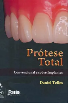 Livro Protese Total - Convencional E Sobre Implantes - Resumo, Resenha, PDF, etc.