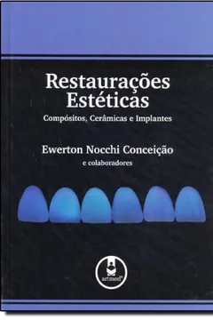 Livro Restaurações Estéticas. Compósitos, Cerâmicas e Implantes - Resumo, Resenha, PDF, etc.