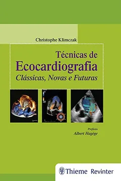 Livro Técnicas de Ecocardiografia: Clássicas, Novas e Futuras - Resumo, Resenha, PDF, etc.