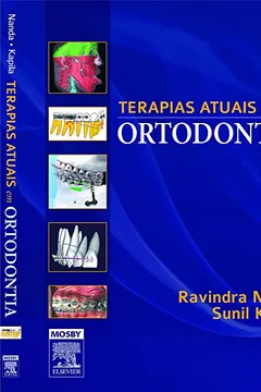 Livro Terapias Atuais em Ortodontia - Resumo, Resenha, PDF, etc.