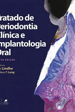 Livro Tratado de Periodontia Clínica e Implantologia Oral - Resumo, Resenha, PDF, etc.